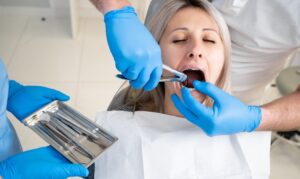 A dentist in blue latex gloves removes her tooth with a buccal retractor and forceps